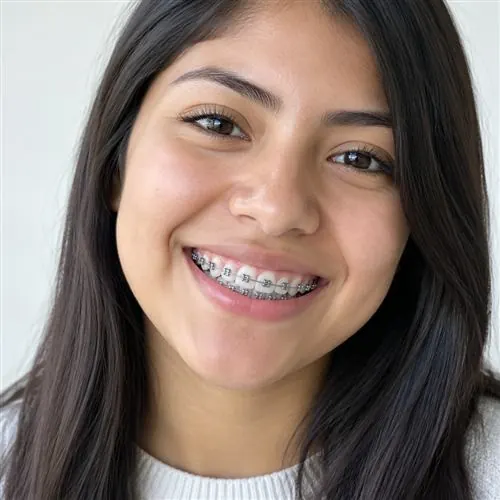 Sonrisa con tratamiento de ortodoncia